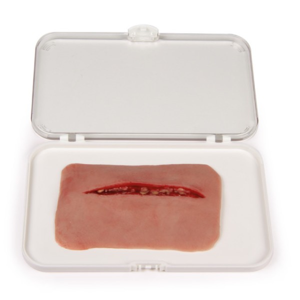 Wundmoulage ERLER-ZIMMER, Schnittwunde