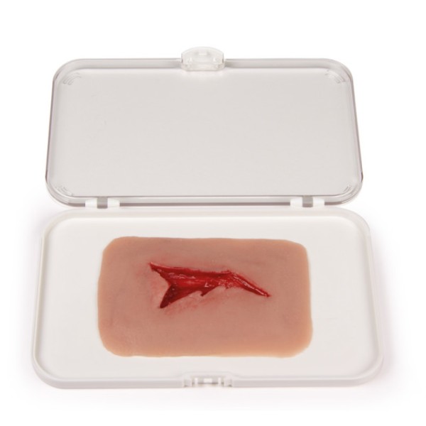 Wundmoulage ERLER-ZIMMER, Risswunde mit
