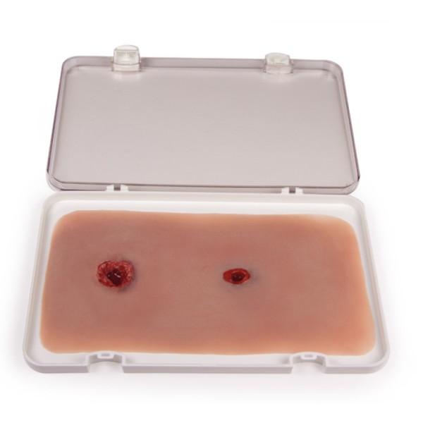 Wundmoulage ERLER-ZIMMER, Schusswunde