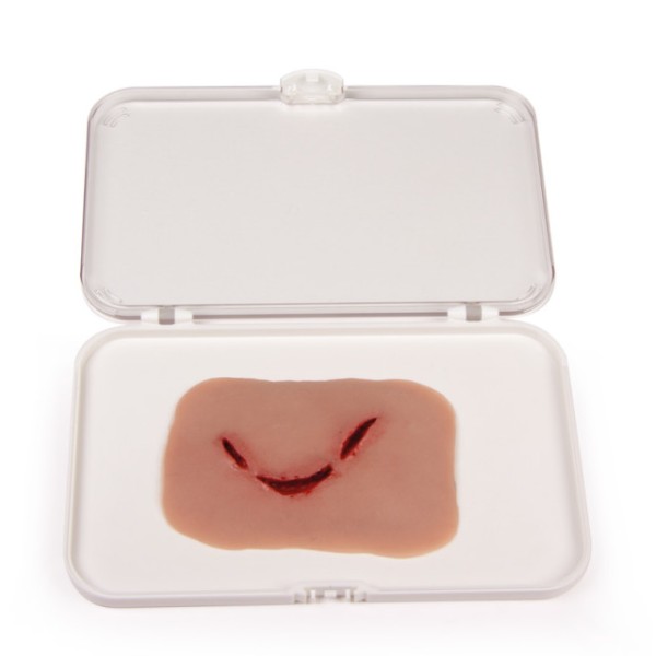 Wundmoulage ERLER-ZIMMER,