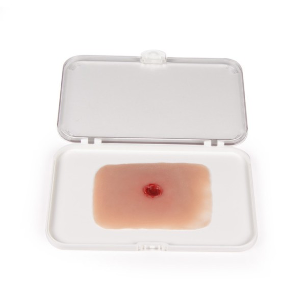 Wundmoulage ERLER-ZIMMER,