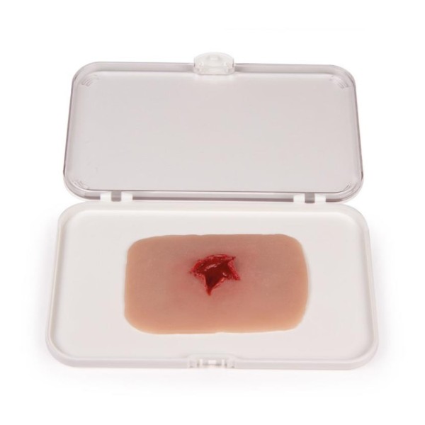 Wundmoulage ERLER-ZIMMER,