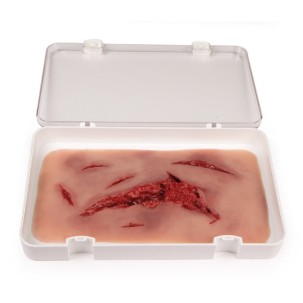 Wundmoulage ERLER-ZIMMER, Risswunde
