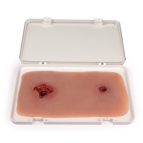 Wundmoulage ERLER-ZIMMER, Schusswunde