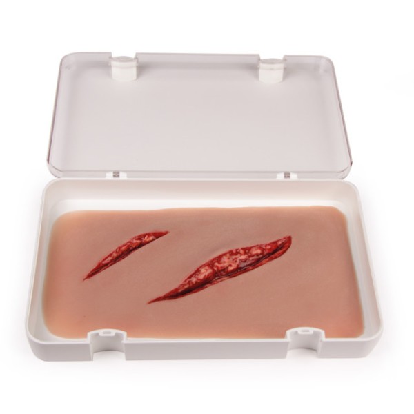Wundmoulage ERLER-ZIMMER, Schnittwunde