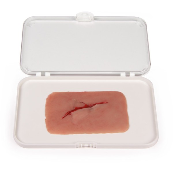 Wundmoulage ERLER-ZIMMER, Schnittwunde